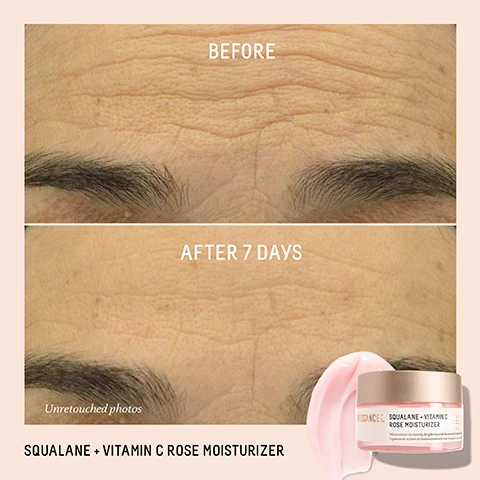Image 1 and 2, before and after 7 days unretouched photos. image 3, immediately 100% saw brighter and more radiant skin. overnight up to 24 hours of hydration. after 4 weeks 100% saw visibly improvement in fine lines and wrinkles. 100% saw improvement in uneven skin tone. based on a consumer study of 40 women aged 30-65 after immediate use. based on a 24 hour clinical study of 24 women aged 30-65. based on a 28 day consumer study of 37 women aged 30-65 with twice daily use. image 4, an education in fermentation. what is fermented lemon peel? a poten brightener and natural alternative to leading brightening ingredients. what are the benefits? it provides antioxidant support to the skin and helps brighten, even skin tone and prevent signs of discoloration. how does fermentation make ingredients work better? fermentation creates the ability to upcycle and reduce waste, while unlocking maximum nutrients for specific ingredients. image 5, find your moisture match. probiotic gel moisturiser - the redness reducer = skin type is oily to combination. texture = lightweight gel. results = calms and soothes while balancing the microbiome. vitamin c rose moisturiser - the instant brightener. skin type = normal to dry. texture = cushion cream. results = brightens complexion and fights free radicals. omega repair cream - the heavy duty hydrator. skin type = dry to mature. texture = rich cream. results = repairs the skin barrier and plumps fine lines and wrinkles. image 6, fermented lemon peel = a natural, more effective alternative to leading chemical ingredients. sugarcane derived squalane = weightlessly hydrates while delivering actives to the skin more effectively. advanced vitamin c (THD ascirbate) = provides support to the skin to neutralise free radicals. image 7, your rose layering guide. step 1 = apply moisturiser. step 2 = apply oil for maximum benefits and to seal in hydration. results = brighter and visibly firmer skin. image 8, bright skin routine. step 1 = treat with marine algae eye cream. step 2 = brighten with vitamin c dark spot serum. step 3 = moisturise with vitamin c rose moisturiser. step 4 = lock in hydration with vitamin c rose oil.