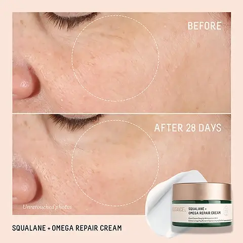 Image 1 - A side-by-side comparison of a persons cheek before and after 28 days of using Squalane and Omega Repair Cream, showing improved skin texture and reduced dryness, with the jar of cream and text reading SQUALANE + OMEGA REPAIR CREAM in the corner.
Image 2 - A jar of Squalane + Omega Repair Cream is shown with a cream topping, surrounded by a light green background, featuring text that states 100% showed improvement in skin hydration after 5 minutes, 94% showed improvement in wrinkles in 1 week, and 97% agreed their skin appeared firmer, with additional notes about clinical studies and awards.
Image 3 - Image shows a light green background with three textured liquid drops and a piece of aloe vera, accompanied by text describing ingredients: Sugarcane Squalane replenishes skin with weightless moisture, Multi-Hyaluronic Acid high molecular weight moisture visibly plumps skin, Omega Fatty Acids + Ceramides deeply nourishes and reinforces skins moisture barrier.
Image 4 - A stacked arrangement of two jars of Biossance Squalane + Omega Repair Cream, with the top jar labeled Jumbo Size (100 mL) and the bottom jar labeled Full Size (50 mL), both featuring a gold lid and green cream inside, against a light background.
Image 5 - Close-up of a droplet on a green plant stem, with text that reads SQUALANE THE SUPERHYDRATOR, A MOLECULAR MOISTURE MATCH TO YOUR SKIN, SUGARCANE-DERIVED OIL IN EVERY BIOSSANCE FORMULA, BOOSTS ABSORPTION OF ACTIVE INGREDIENTS BY 40X, C30H62.