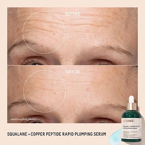 Before. Day 28. Squalane and Copper Peptide Rapid Plumping Serum.