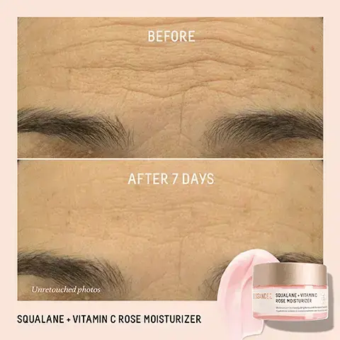 Image 1, BEFORE AFTER 7 DAYS Unretouched photos SQUALANE + VITAMIN C ROSE MOISTURIZER SINCE SQUALANE VITAMING ROSE MOISTURIZER Image 2, BIOSSANCE:. SQUALANE + VITAMIN C ROSE OIL Facial Oil to Visibly Brighten Firm Huile visage pour éclaircir et raffermir v AFTER 3 WEEKS 97% agree skin firmness and suppleness is improved1 91% agree skin appears younger looking! 91% agree skin has a healthy radiant glow! Based on a 21-day consumer study of 32 women, ages 18-63. efter 21 days of twice daily use Image 3- The image shows a two-step skincare routine featuring a Biossance Squalane + Vitamin C Rose Moisturizer jar for Step 1, which Brightens + Hydrates, and a Biossance Squalane + Vitamin C Rose Oil dropper bottle for Step 2, which Firms + Boosts Radiance, all presented under the title AWARD WINNING DUO ROUTINE and an Allure Best of Beauty Award Winner 2025 seal, with both products noting PLANT DERIVED SQUALANE.