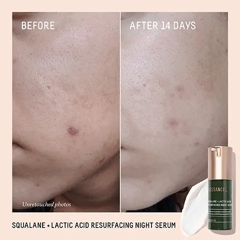 Image 1, BEFORE AFTER 14 DAYS Unretouched photos SQUALANE + LACTIC ACID RESURFACING NIGHT SERUM SSANCER LANE LACE RADING NIGHT Image 2, BEFORE AFTER 2 DAYS AFTER 22 DAYS Unretouched photos SQUALANE + PROBIOTIC GEL MOISTURIZER ROSSANCE SQUALANE. PROBIOTIC GEL MOISTURIZER Image 3, USSANCE. LANE LACTIC ACID SURFACING NIGHT SERUM Exfoliates Skin Overnigh geolie la peau pendant AFTER 1 NIGHT Panelists showed +113% improvement in skin hydration' 100% showed improvement in the appearance of pores1 100% showed a visible reduction in the appearance of fine lines and wrinkles1 Based on a clinical study of 36 female subjects, oges 30-60. cfter one use Image 4, SSANCE: SQUALANE • PROBIOTIC GEL MOISTURIZER AFTER 1USE 100% agree their skin looks calm and less irritated1 94% showed improvement in pore size2 AFTER 1 WEEK 94% agree redness was visibly improved1 AFTER 4 WEEKS 97% agree their skin looks clearer1 Based on a 4 week consumer study of 33 women, ages 18-50 *Based on a 4 week clinical study of 33 women, ages 18-50 Image 5, 10% VEGAN LACTIC ACID Gently smooths overnight for visibly glowing, radiant skin in the morning SUGARCANE-DERIVED SQUALANE Provides weightless hydration and locks in BIOSSANCES long-lasting moisture SQUALANE LACTIC AC RESURFACING NIGHT SE ◆ CLOVER Boosts lactic's exfoliating benefits by reviving up cell turnover PR62 Image 6, ENCAPSULATED PROBIOTICS Supports skin's microbiome with potent, active cultures SUGARCANE-DERIVED SQUALANE Provides weightless hydration without clogging pores BOSSANCE SQUALANE + PROBIOTIC GEL MOISTURIZER Get Moisture Calm Reaction Mi Grant called Ô BISABOLOL Soothes irritation, reduces redness, and instantly relieves skin