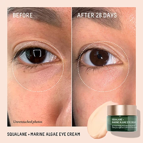 Image 1 - A side-by-side comparison showing the area around an eye before using Squalane + Marine Algae Eye Cream and after 28 days of use, with text indicating BEFORE on the left and AFTER 28 DAYS on the right, along with a jar of the eye cream and the text SQUALANE + MARINE ALGAE EYE CREAM at the bottom.
Image 2 - Image shows a side-by-side comparison of skin on a persons cheek before and after 28 days of using Squalane + Omega Repair Cream, with the text BEFORE and AFTER 28 DAYS above the respective images and the product jar displayed at the bottom right.
Image 3 - Image shows a comparison of skin texture before and after using a product, with BEFORE (0 DAYS) at the top and AFTER (28 DAYS) below, along with a bottle of Squalane + Vitamin C Rose Oil beside the text SQUALANE + VITAMIN C ROSE OIL and unretouched photos.
Image 4 - A green jar of Squalane + Marine Algae Eye Cream on a light beige background, with percentages highlighting user satisfaction: 97% showed improvement in the appearance of fine lines and wrinkles after one use, 97% agree the skin around their eye area appears firmer after one use, and 94% agree the look of their dark circles is improved after one week, along with footnotes regarding the studies.
Image 5 - A jar of Squalane + Omega Repair Cream with a white cream on top is shown, alongside claims of user satisfaction: 100% improved skin hydration after 5 minutes, 94% improved visible lines and wrinkles after 1 week, and 97% agreed their skin appeared firmer after 4 weeks.
Image 6 - Image shows a bottle of Biossance Squalane + Vitamin C Rose Oil with a dropper cap beside it, accompanied by text that states: AFTER 3 WEEKS 97% agree skin firmness and suppleness is improved 91% agree skin appears younger looking 91% agree skin has a healthy radiant glow.
Image 7 - Image shows a jar of Squalane + Marine Algae Eye Cream with a light pink cream inside, accompanied by a piece of aloe vera and dark red algae, with text indicating ingredients and benefits: Paracress Extract Quickly smooths and firms skin, Sugarcane-derived Squalane Weightlessly locks in moisture, Marine Algae Complex Visibly reduces fine lines and wrinkles.
Image 8 - A jar of Biossance Squalane + Omega Repair Cream is prominently displayed with green and gold packaging, surrounded by water droplets and berries, with text highlighting the benefits of ceramides and fatty acids, hyaluronic acid, and squalane.
Image 9 - A bottle of Biossance Squalane + Vitamin C Rose Oil sits on a light background, surrounded by a pink rose petal and an orange slice, with text that reads Chios Crystal Oil Helps revitalize the skin while visibly improving firmness, Sugarcane-derived Squalane Weightlessly locks in essential moisture, and Advanced Vitamin C (THD Ascorbate) An oil-soluble, stable form of vitamin C that visibly brightens the skin.