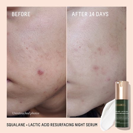 Squalane + 10% Lactic Acid Resurfacing Serum - Image 4