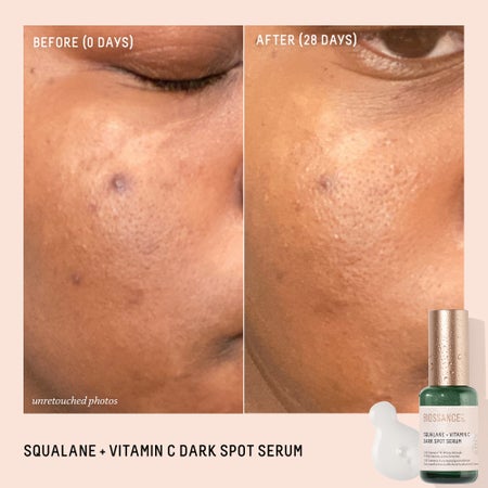 Squalane + Vitamin C Dark Spot Serum Travel Size Image 1