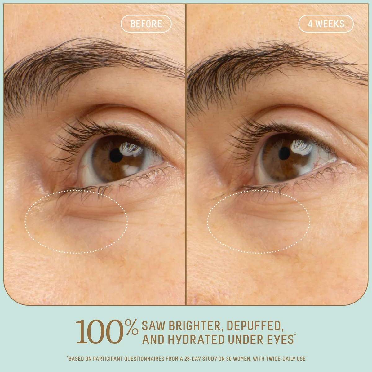 Squalane + 5% Niacinamide Brightening Eye Serum