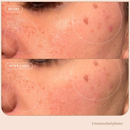 Squalane + 10% Azelaic Pore Minimizing Mask Image 4